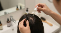 12 Best Hair Loss Treatments in 2026